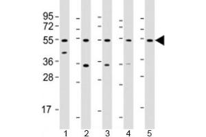 Western blot testing of human 1) liver, 2) HeLa, 3) PC-3, 4) SK-BR-3 and 5) TT cell lysate with THRB antibody at 1:2000. (THRB 抗体  (AA 23-55))