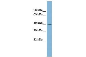 CK1 gamma 2 antibody used at 1 ug/ml to detect target protein. (Casein Kinase 1 gamma 2 抗体  (Middle Region))