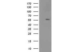 HEK293T cells were transfected with the pCMV6-ENTRY control (Left lane) or pCMV6-ENTRY TP53 (Right lane) cDNA for 48 hrs and lysed. (p53 抗体)