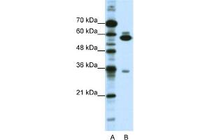 WB Suggested Anti-ZNF446 Antibody Titration:  1. (ZNF446 抗体  (C-Term))