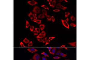 Immunofluorescence (IF) image for anti-Ribosomal Protein L9 (RPL9) antibody (ABIN7008395)