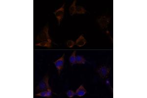 Immunofluorescence (IF) image for anti-Interleukin 13 Receptor, alpha 2 (IL13RA2) antibody (ABIN7267987)