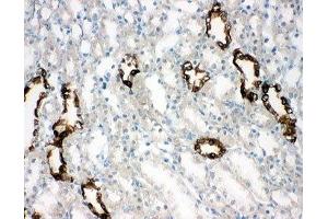 IHC-F testing of AQP2 antibody and rat kidney tissue (AQP2 抗体  (AA 245-260))
