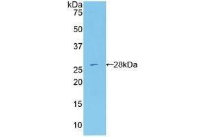 Detection of Recombinant RIG1, Mouse using Polyclonal Antibody to Probable ATP-dependent RNA Helicase DDX58 (DDX58) (DDX58 抗体  (AA 1-211))