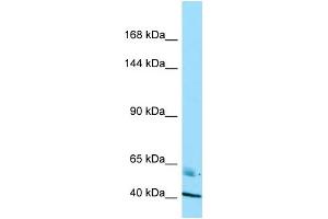 Western Blotting (WB) image for anti-Ras Association and DIL Domains (Radil) (C-Term) antibody (ABIN2789578) (Radil 抗体  (C-Term))