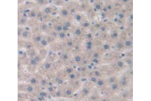 IHC-P analysis of Rat Tissue, with DAB staining. (IL-6 Receptor 抗体  (AA 214-348))