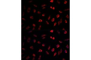 Immunofluorescence analysis of L929 cells using NEDD1 antibody (ABIN1681008, ABIN3019378, ABIN3019379 and ABIN6220853) at dilution of 1:100. (NEDD1 抗体  (AA 411-660))