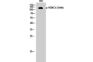 Western Blotting (WB) image for anti-Histone Deacetylase 5 (HDAC5) (pSer498) antibody (ABIN5956856) (HDAC5 抗体  (pSer498))