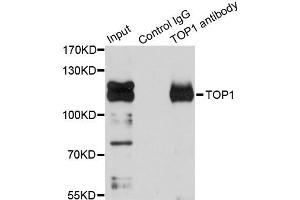 Immunoprecipitation analysis of 150ug extracts of Jurkat cells using 3ug TOP1 antibody. (Topoisomerase I 抗体)