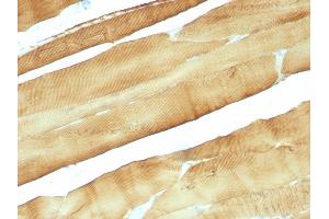 Formalin-fixed, paraffin-embedded Rat Skeletal Muscle stained with Muscle Specific Actin Mouse Monoclonal Antibody (MSA/953). (ACTA1/ACTA2A/ACTG2 抗体)