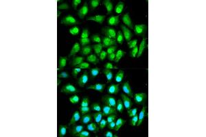 Immunofluorescence analysis of HeLa cells using RAN antibody.