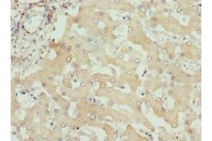 Immunohistochemistry of paraffin-embedded human liver tissue using ABIN7156320 at dilution of 1:100 (ITPK1 抗体  (AA 185-414))