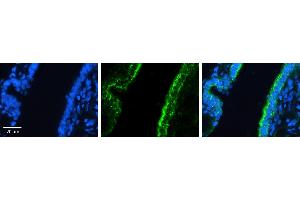 Immunohistochemistry (IHC) image for anti-Ras Homolog Family Member D (RHOD) (C-Term) antibody (ABIN2775404)