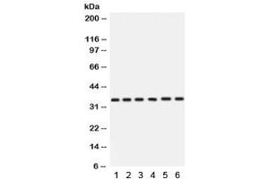 Western blot testing of 1) rat stomach, 2) rat thymus, 3) human HeLa, 4) A549, 5) SKOV and 6)  22RV1 with Cdk4 antibody. (CDK4 抗体  (AA 201-303))