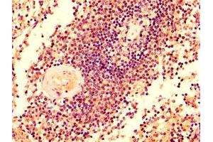 IHC image of ABIN7145433 diluted at 1:500 and staining in paraffin-embedded human spleen tissue performed on a Leica BondTM system.