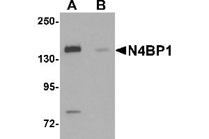Western blot analysis of N4BP1 in HeLa cell lysate with N4BP1 antibody at 0. (N4BP1 抗体  (N-Term))