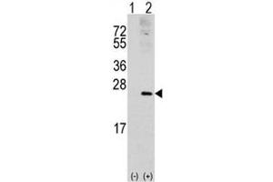 Western blot analysis of RAC1 antibody and 293 cell lysate (2 ug/lane) either nontransfected (Lane 1) or transiently transfected with the RAC1 gene (2). (RAC1 抗体  (AA 49-78))