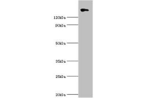 Western blot All lanes: Collagen alpha-1 (II) chain antibody at 10 μg/mL + 293T whole cell lysate Secondary Goat polyclonal to rabbit IgG at 1/10000 dilution Predicted band size: 142, 135, 30 kDa Observed band size: 142 kDa (COL2A1 抗体  (AA 1228-1487))