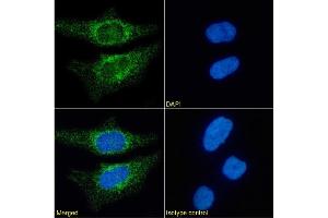 Immunofluorescence staining of HeLa cells using anti-CD171. (Recombinant L1CAM 抗体)