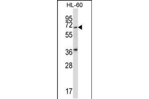 Western blot analysis in HL-60 cell line lysates (35ug/lane). (PKMYT1 抗体  (N-Term))