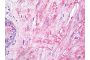 Human Prostate, Smooth Muscle: Formalin-Fixed, Paraffin-Embedded (FFPE) (Vinculin 抗体  (AA 356-607))