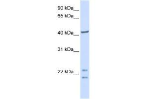 WB Suggested Anti-C16orf48 Antibody Titration:  0. (ENKD1 抗体  (C-Term))
