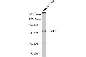 Western blot analysis of extracts of Mouse brain using GTF2I Polyclonal Antibody at dilution of 1:500. (GTF2I 抗体)