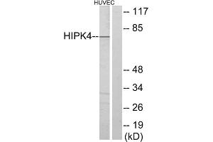 Western blot analysis of extracts from HUVEC cells, using HIPK4 antibody. (HIPK4 抗体  (C-Term))