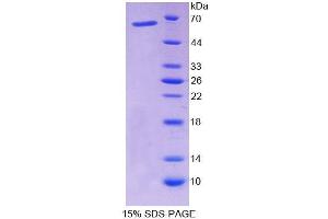 SDS-PAGE analysis of Rat NFIX Protein. (NFIX 蛋白)