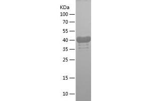 Western Blotting (WB) image for Hyaluronan-Mediated Motility Receptor (RHAMM) (HMMR) (AA 1-300) protein (His tag) (ABIN7282559) (HMMR Protein (AA 1-300) (His tag))