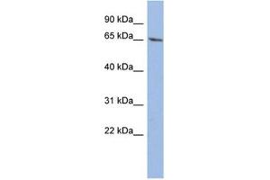 Western Blotting (WB) image for anti-Wilms Tumor 1 (WT1) (C-Term) antibody (ABIN604665) (WT1 抗体  (C-Term))