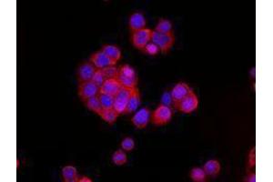 Immunofluorescence (IF) image for anti-Cadherin 1, Type 1, E-Cadherin (Epithelial) (CDH1) antibody (Alexa Fluor 594) (ABIN2656828) (E-cadherin 抗体  (Alexa Fluor 594))