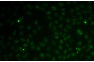 Immunofluorescence analysis of MCF7 cells using RAD51C Polyclonal Antibody (RAD51C 抗体)
