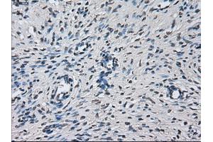 Immunohistochemical staining of paraffin-embedded liver tissue using anti-PRLmouse monoclonal antibody. (Prolactin 抗体)