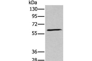 Western blot analysis of Human fetal brain tissue lysate using GPC5 Polyclonal Antibody at dilution of 1:450 (GPC5 抗体)
