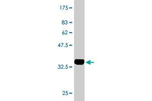 Western Blot detection against Immunogen (34. (LASS4 抗体  (AA 57-139))