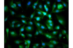 Immunofluorescence staining of U251 cells with ABIN7170480 at 1:166, counter-stained with DAPI. (SPAG6 抗体  (AA 343-428))