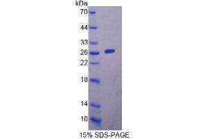 SDS-PAGE analysis of Mouse YAF2 Protein. (YAF2 蛋白)