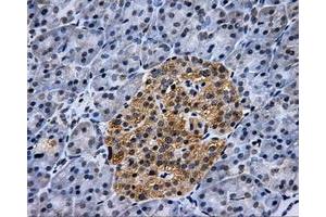 Immunohistochemical staining of paraffin-embedded pancreas tissue using anti-HK2mouse monoclonal antibody. (Hexokinase 2 抗体)