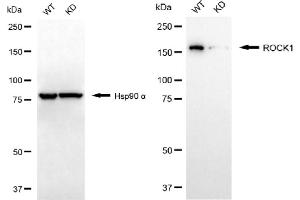 Western blotting analysis using ROCK1 antibody (ABIN7800202). (Recombinant ROCK1 抗体)