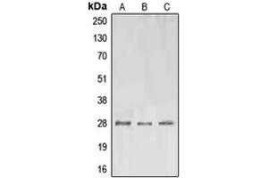 Western blot analysis of EPO expression in A549 (A), SP2/0 (B), PC12 (C) whole cell lysates. (EPO 抗体  (Center))