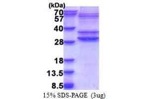 SDS-PAGE (SDS) image for PMF1-BGLAP Readthrough (PMF1-BGLAP) (AA 1-211) protein (His tag) (ABIN5853356)
