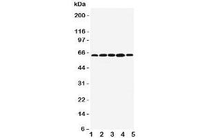 Western blot testing of BAG3 antibody;  Lane 1: MCF-7;  2: Jurkat;  3: A549;  4: HeLa;  5: COLO320 cell lysate. (BAG3 抗体  (C-Term))