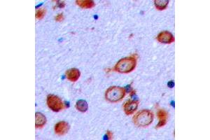 Immunohistochemical analysis of PTHR1 staining in human brain formalin fixed paraffin embedded tissue section. (PTH1R 抗体  (Center))
