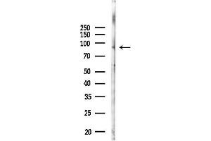 Western blot analysis of lysates from Mouse lung, using RASAL1 Antibody at 1/1000 dilution.