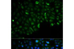 Immunofluorescence analysis of U2OS cells using HK2 Polyclonal Antibody (Hexokinase 2 抗体)
