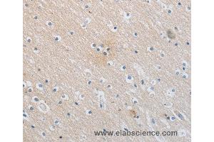 Immunohistochemistry of Human brain  using SLC16A7 Polyclonal Antibody at dilution of 1:30 (SLC16A7 抗体)