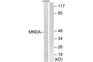 Western blot analysis of extracts from LOVO cells, using MNDA antibody. (MNDA 抗体  (C-Term))