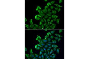 Immunofluorescence analysis of A549 cells using FABP5 antibody. (FABP5 抗体  (AA 1-135))