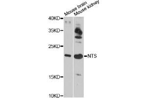 Western blot analysis of extracts of various cell lines, using NTS antibody (ABIN5998396) at 1:3000 dilution. (Neurotensin 抗体)